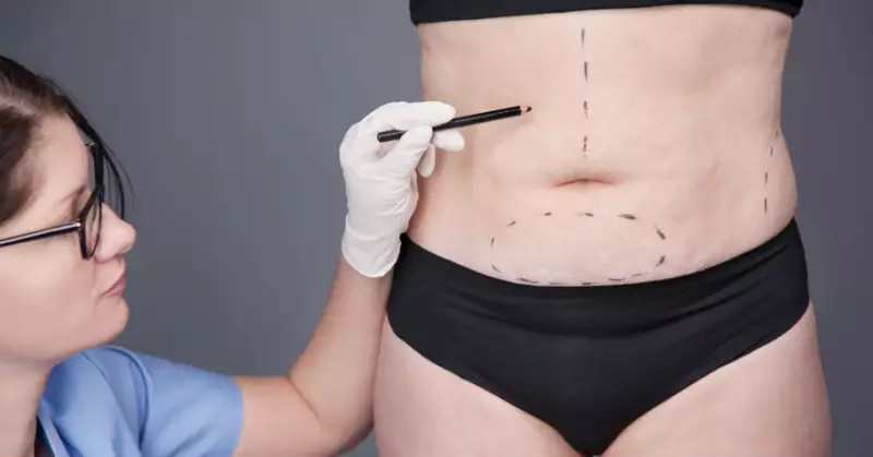 cirurgia-plastica-pos-bariatrica